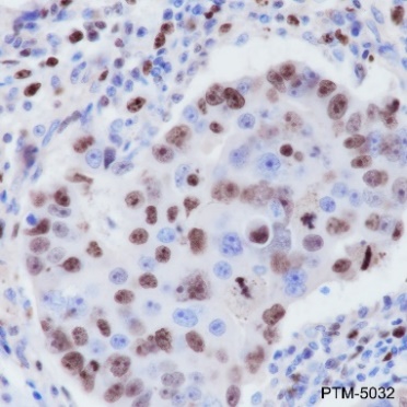 PTM BIO